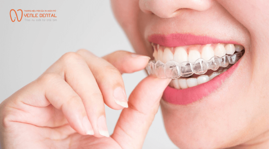 niềng răng invisalign